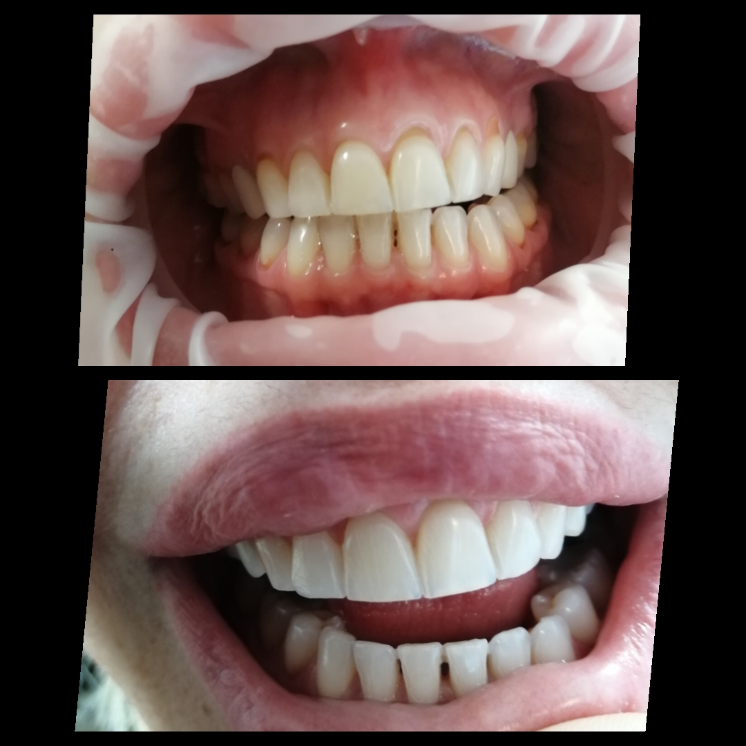 Λεύκανση ιατρείου