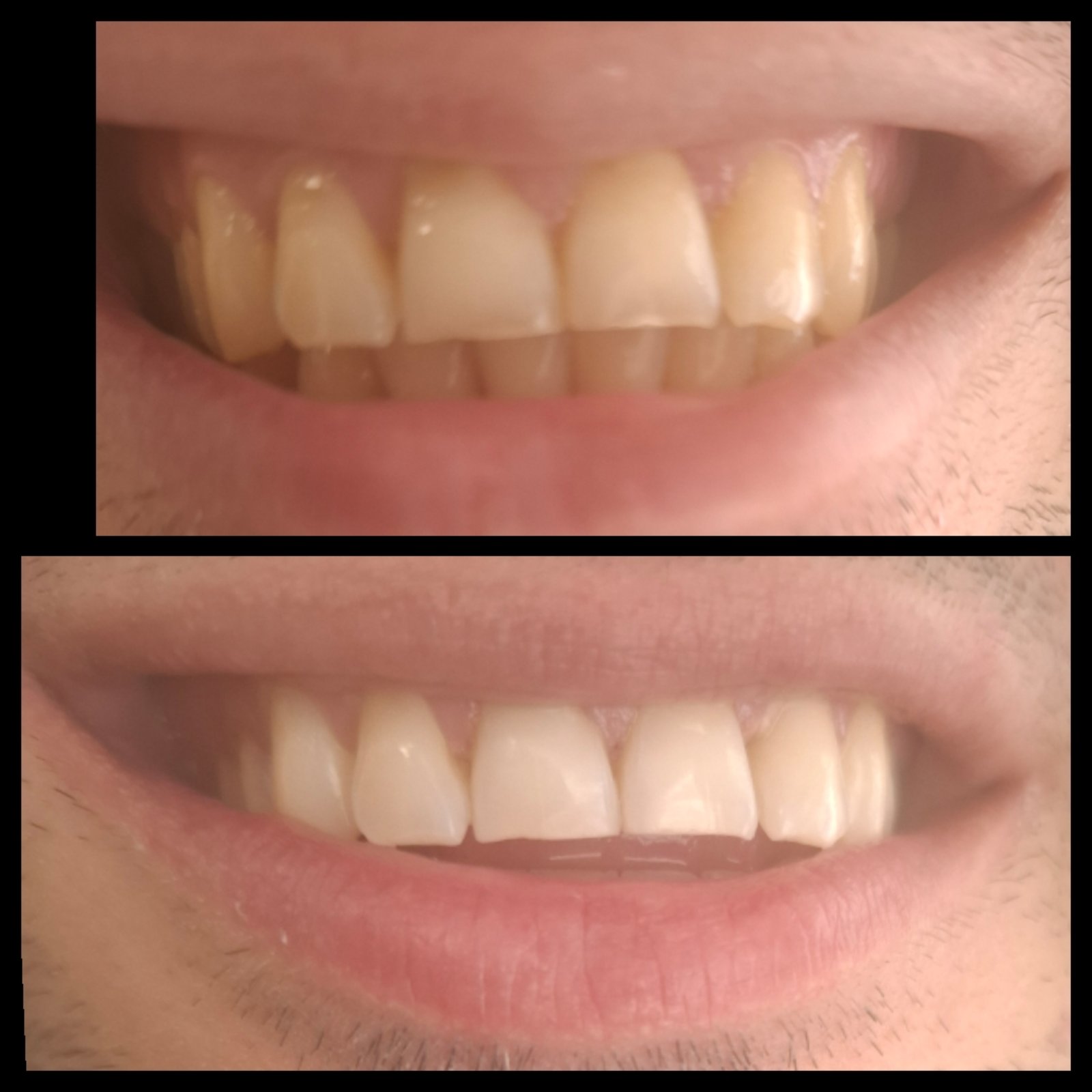 Λεύκανση ιατρείου